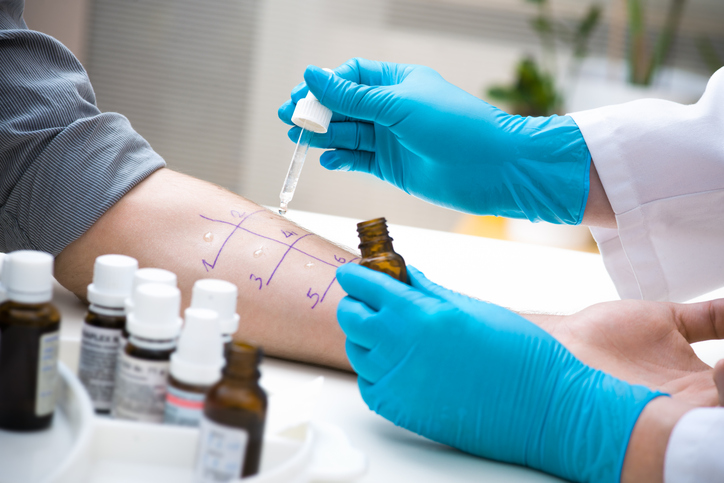 Skin prick allergy to find out kind of allergy